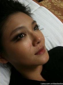 明星肛门,揭秘肛门健康与明星生活